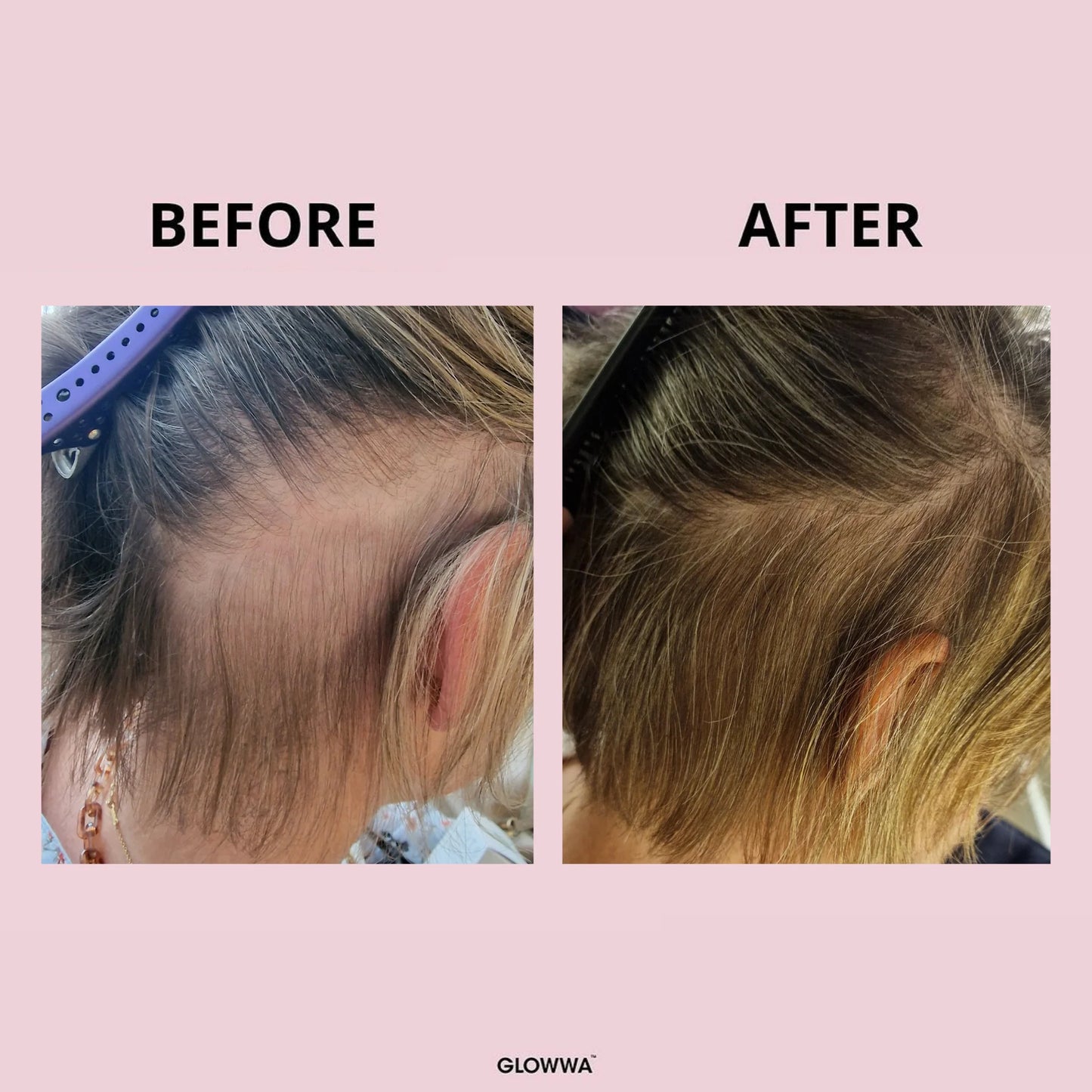 Glowwa - HAIR FOOD - Integratore Professionale per Capelli Sani e Forti