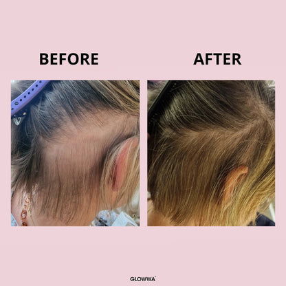 Glowwa - HAIR FOOD - Integratore Professionale per Capelli Sani e Forti