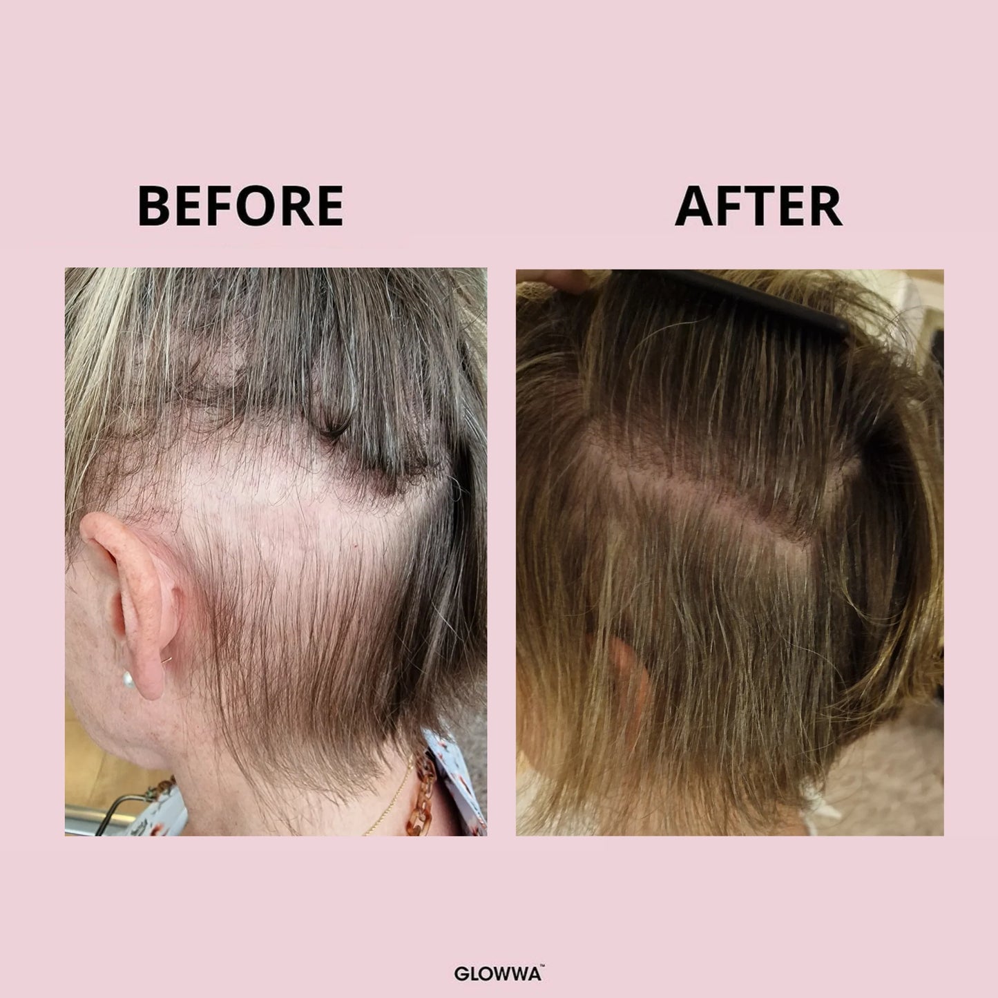Glowwa - HAIR FOOD MENO - Integratore Capelli per la Menopausa