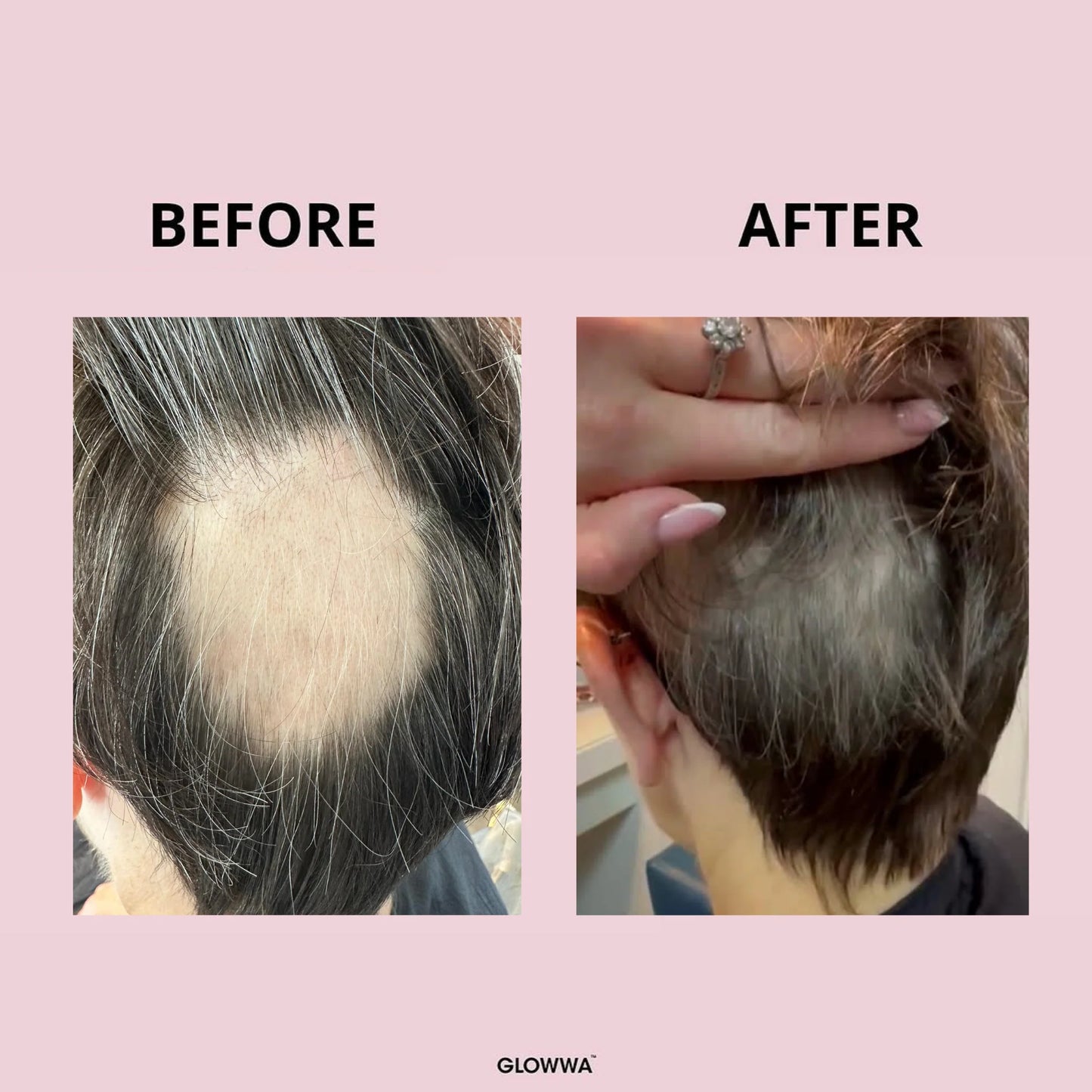 Glowwa - HAIR FOOD MENO - Integratore Capelli per la Menopausa