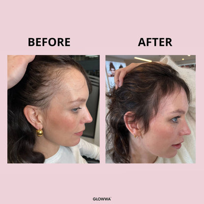 Glowwa - HAIR FOOD - Integratore Professionale per Capelli Sani e Forti