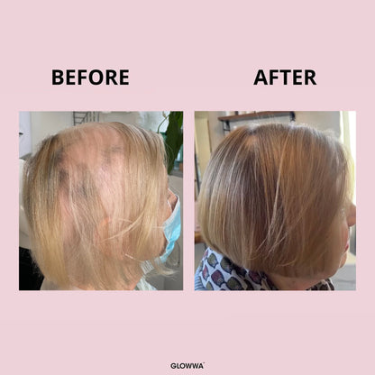 Glowwa - HAIR FOOD - Integratore Professionale per Capelli Sani e Forti