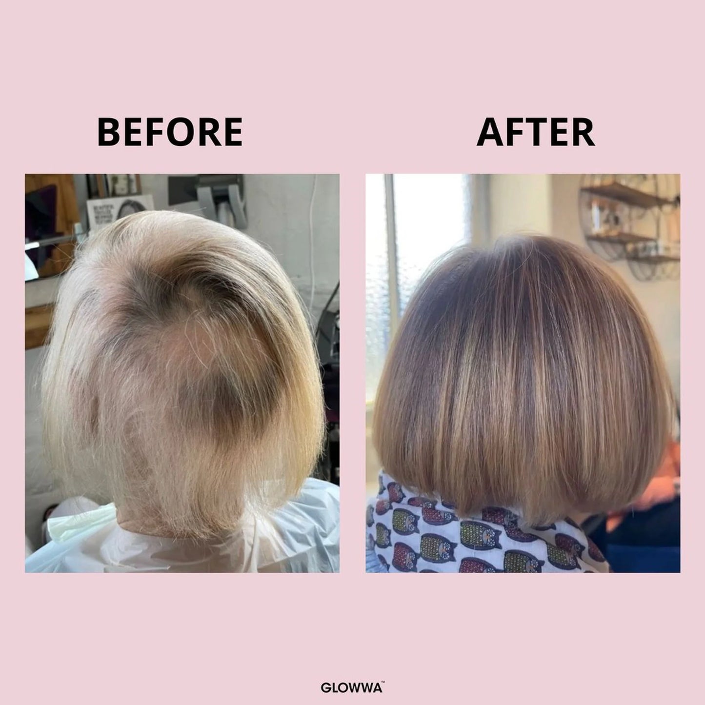 Glowwa - HAIR FOOD - Integratore Professionale per Capelli Sani e Forti